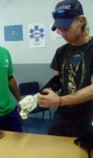 Figure 2-16 shows the attached prototype hand and the amputee learning to operate it. 