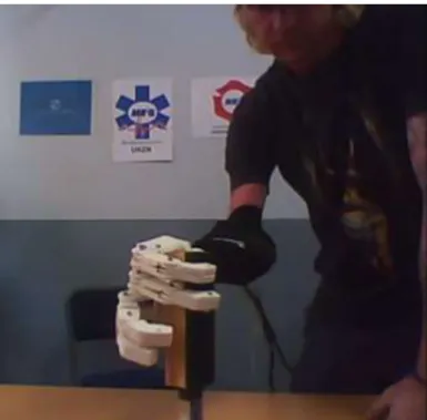 Figure  2-25  shows  the  amputee  balancing  the  chalk  duster  on  the  small  cylinder