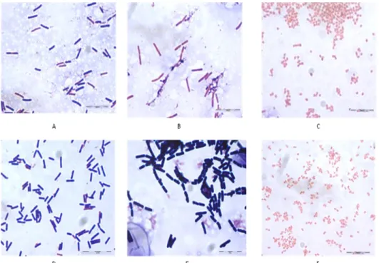 Fig.  3.1.  Gram  stained  cells  of  GM  isolates  at  a  100  X  magnification.  The  isolates  were  all  incubated for 16 h
