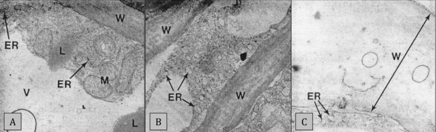 Figure  2:  Electron  micrographs  of  mesocarp  cell  wall  of  an  (A)  unripe,  (B)  climacteric  and  (C)  ripe  fruit,  taken  from Platt-Aloia (1980)