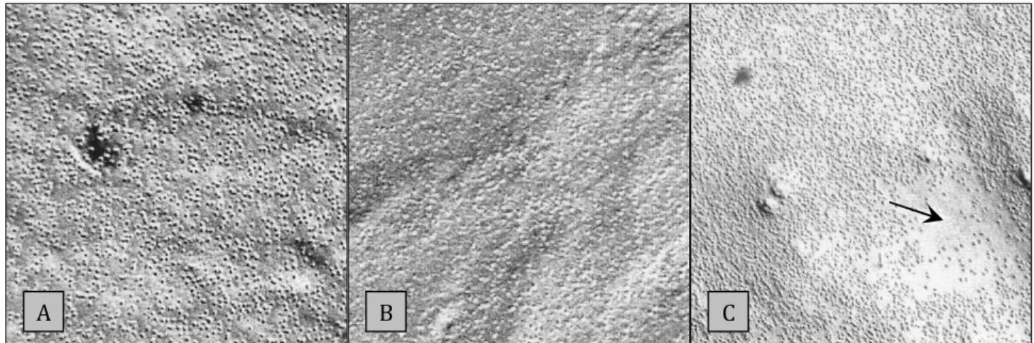 Figure 7: Electron micrograph of a freeze fracture replica of the cell membrane from an (A) unripe, (B) ripe and  (C) chilling injured fruit, taken from Platt-Aloia (1980)