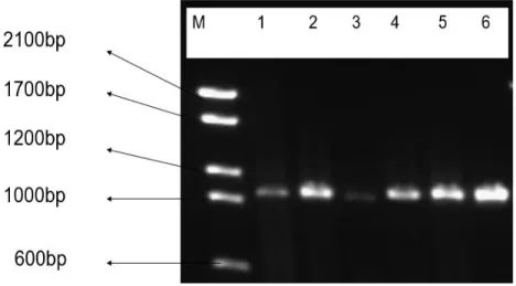 Figure  3:  The  amplification  of  OMP1  gene  VS1-VS4  of  C.  trachomatis.  M  is  a  Molecular  marker  and  Lane  1-5  represent  the  PCR  products  of  the  clinical  strains  and  6 is  control,  CDC laboratory strain (F)