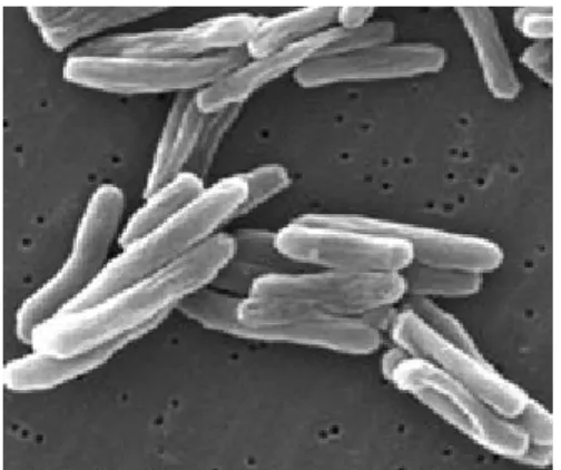 Figure 4: Electron microscope image  of Mycobacterium tuberculosis [CDC].