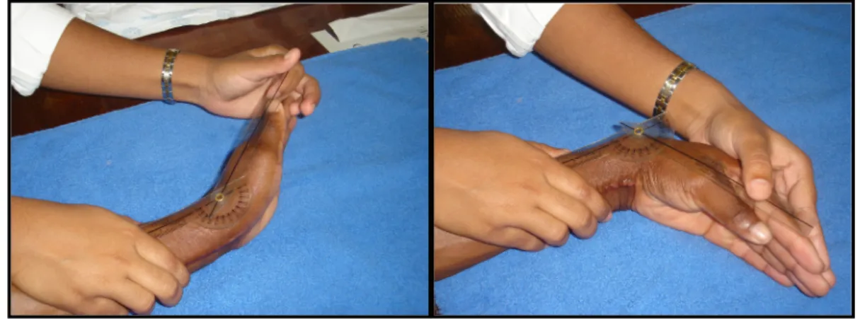 Figure 7: Goniometry of wrist extension   Figure 8: Goniometry of wrist flexion 