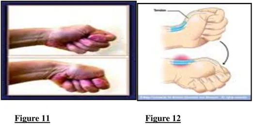 Figure 11  Figure 12 
