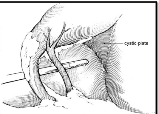 Figure 7: - Critical view of safety 12  