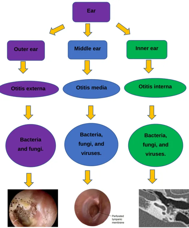 Figure 2. 2 Flow chart indicating the three parts of the ear and the type of infection