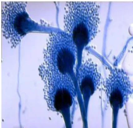Figure 2. 3 Microscopic image of Aspergillus fumigatus (Adhavan, 2020). 