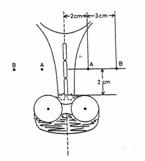Figure 2.2   Manchester system definition of points “A” and ”B” 